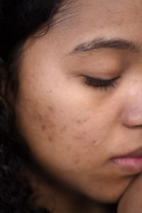 pexels-ron-lach-9253763